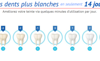 Le blanchiment des dents: Allez chez le dentiste vs. DIY(fais le par toi-même)