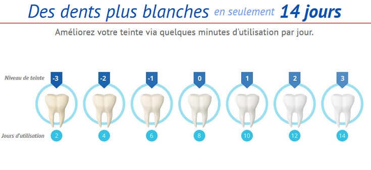 Le blanchiment des dents: Allez chez le dentiste vs. DIY(fais le par toi-même)